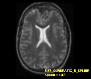 medical size quadratic b-spline