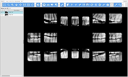 In vivo dental viewer windows 10 не запускается