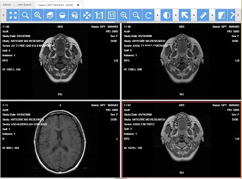 download horos dicom viewer